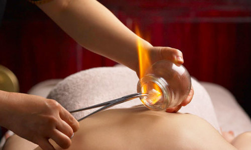 <h2>Fire Cupping</h2><div class='slide-content'><p><span class='highlight'></span></p><p><span class='highlight'>fire cupping is a type of deep tissue massage that promotes stress relief and relaxation. As a medicinal therapy, cupping has been used with bronchitis, asthma, colds, digestive diseases, musculoskeletal pain, some gynecological disorders, gastro-intestinal disorders, lung diseases, and paralysis as well as for other disorders. </span></p></div><a href='https://naturalhealthnovascotia.com/fire-cupping/' class='btn' title='Read more'>Read more</a>